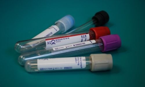 Blood Lab Test Biomarkers