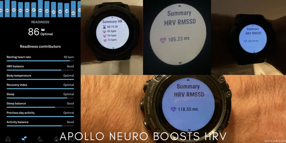 Apollo Neuro HRV Recovery Oura Scores product image