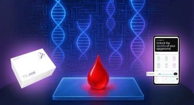 Inside The Revolutionary Epigenetic Cellular Health Test (1,700 Biomarkers from a Drop of Blood)